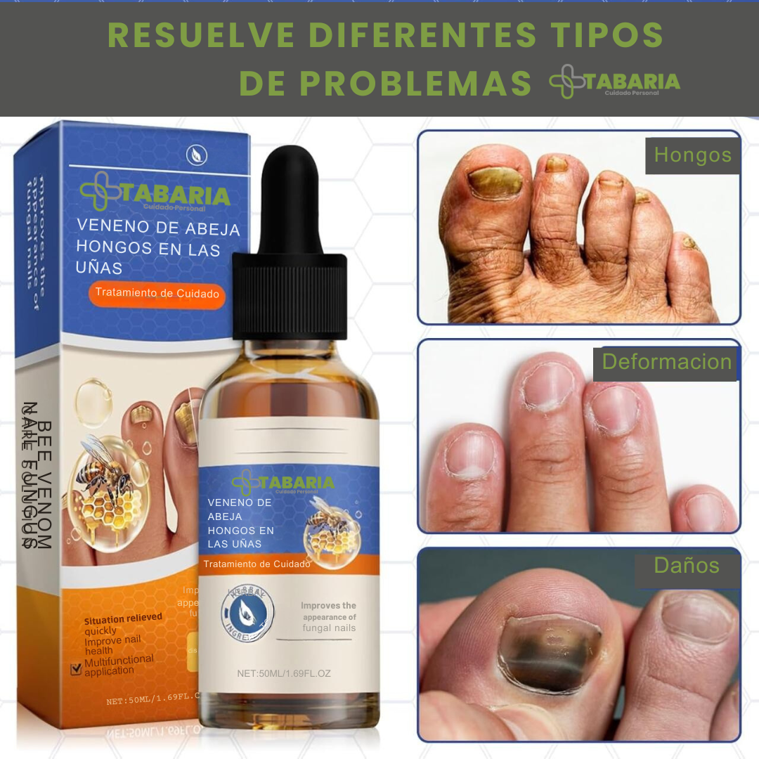 Sérum para Uñas: Uñas Sanas y más fuertes desde la primera semana.