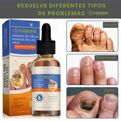 Sérum para Uñas: Uñas Sanas y más fuertes desde la primera semana.