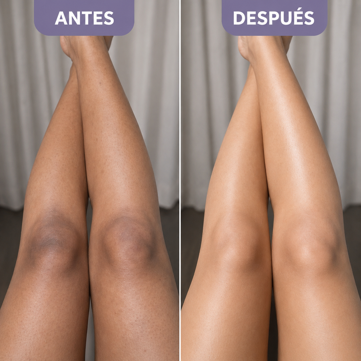 Spray Dr. Melaxin - Recupera la confianza de mostrar tu piel