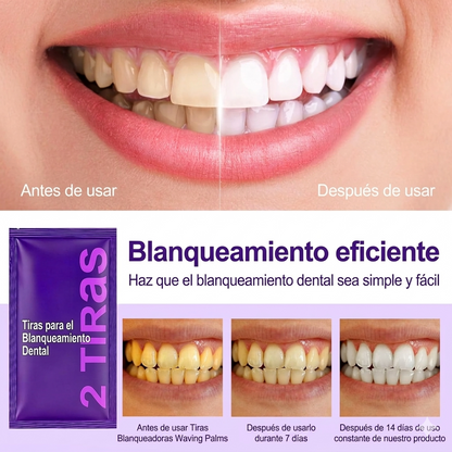 Tabaria™ | Dientes más blancos en 30 minutos