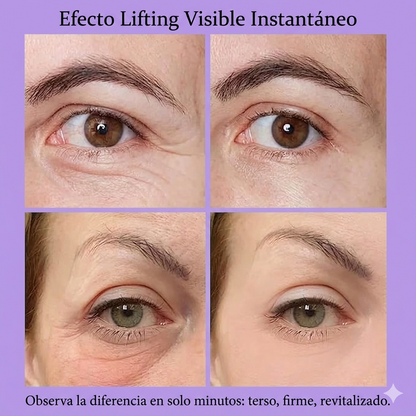 Adiós Bolsas de ojos en Minutos — Tabaria