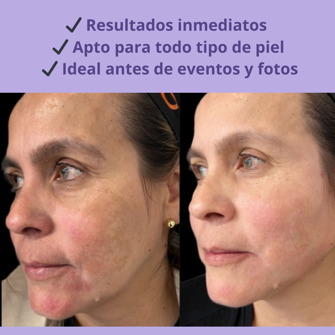 Lifting Visible en 20 Minutos-Tratamiento Facial Antiaging